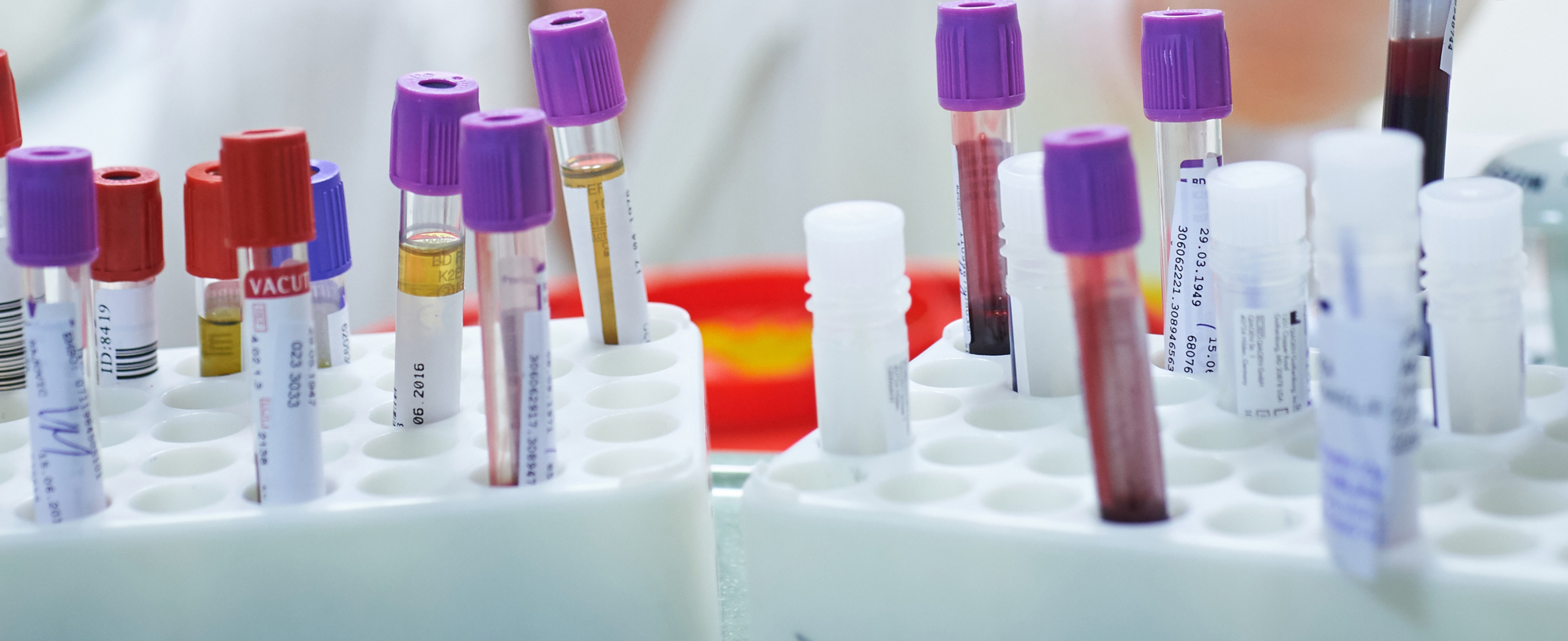Ozadje HIV IMI detajli 198a 1